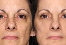 Miraculous Anti-Wrinkle Cream: Everyone Should Know About This Method!